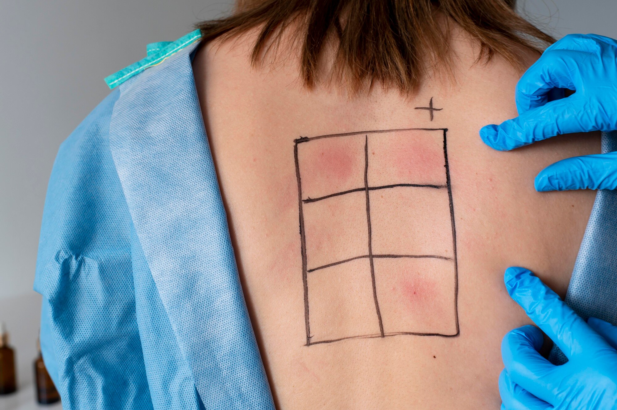 Assessment of a skin rash