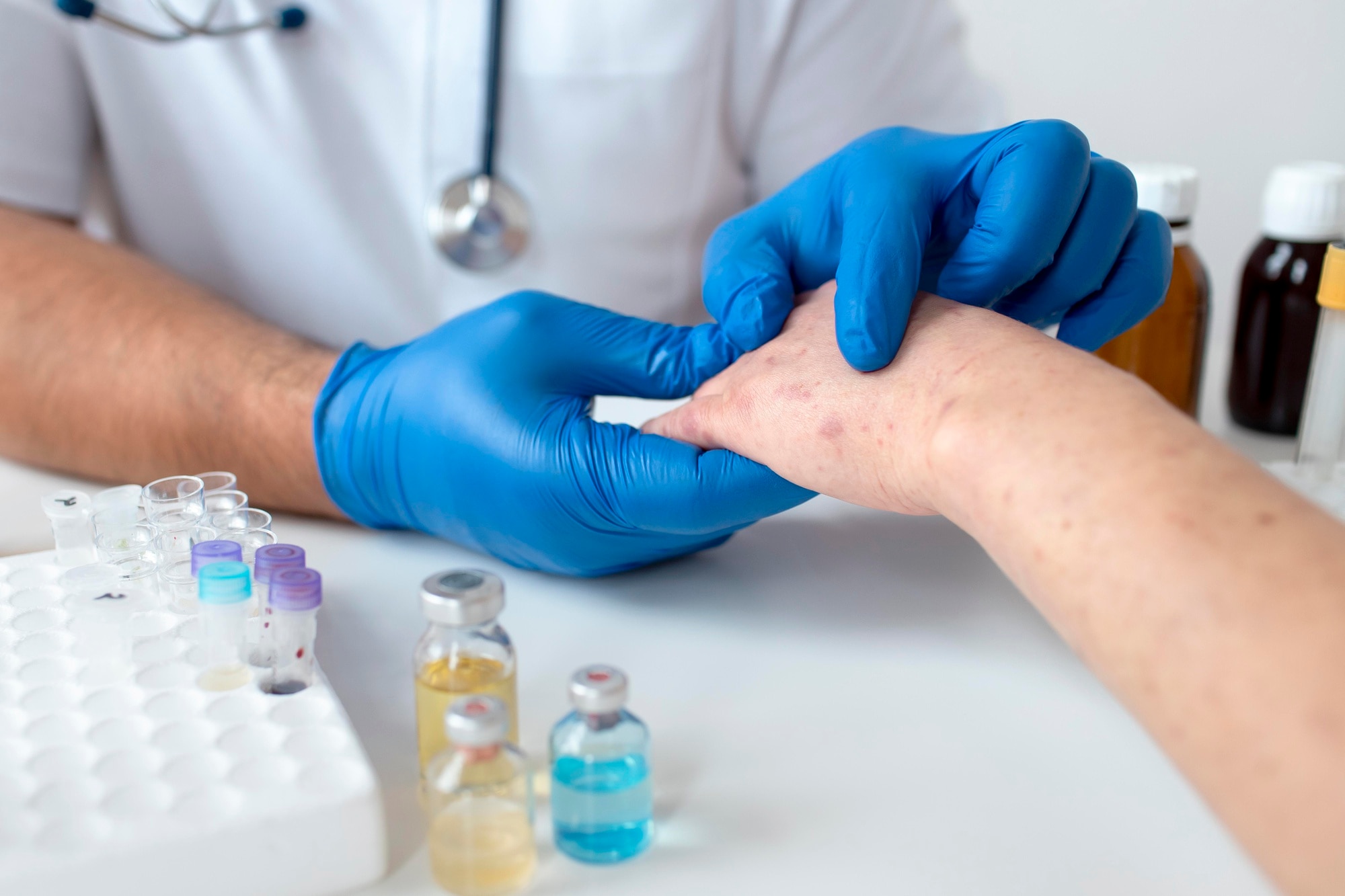Treatment for chronic skin conditions