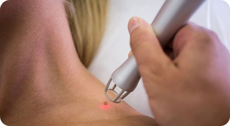 Dermatology treatment